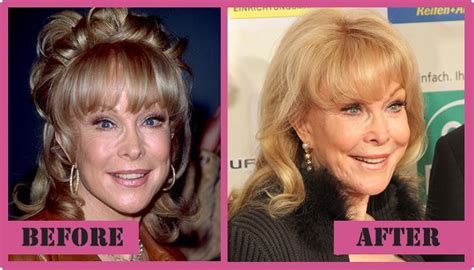 barbara eden nose job|More.